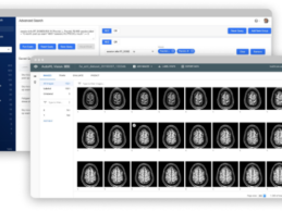 Flywheel Builds Data Platform for Unbiased Breast Imaging AI